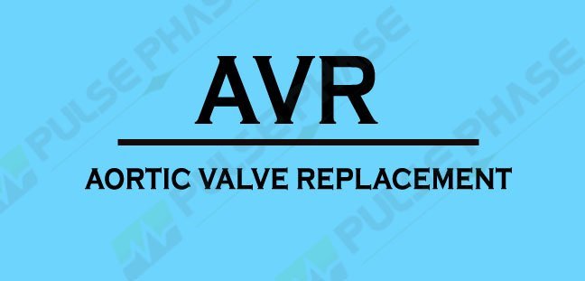 Full form of AVR